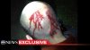 George-Zimmerman-Head-Injury.jpg